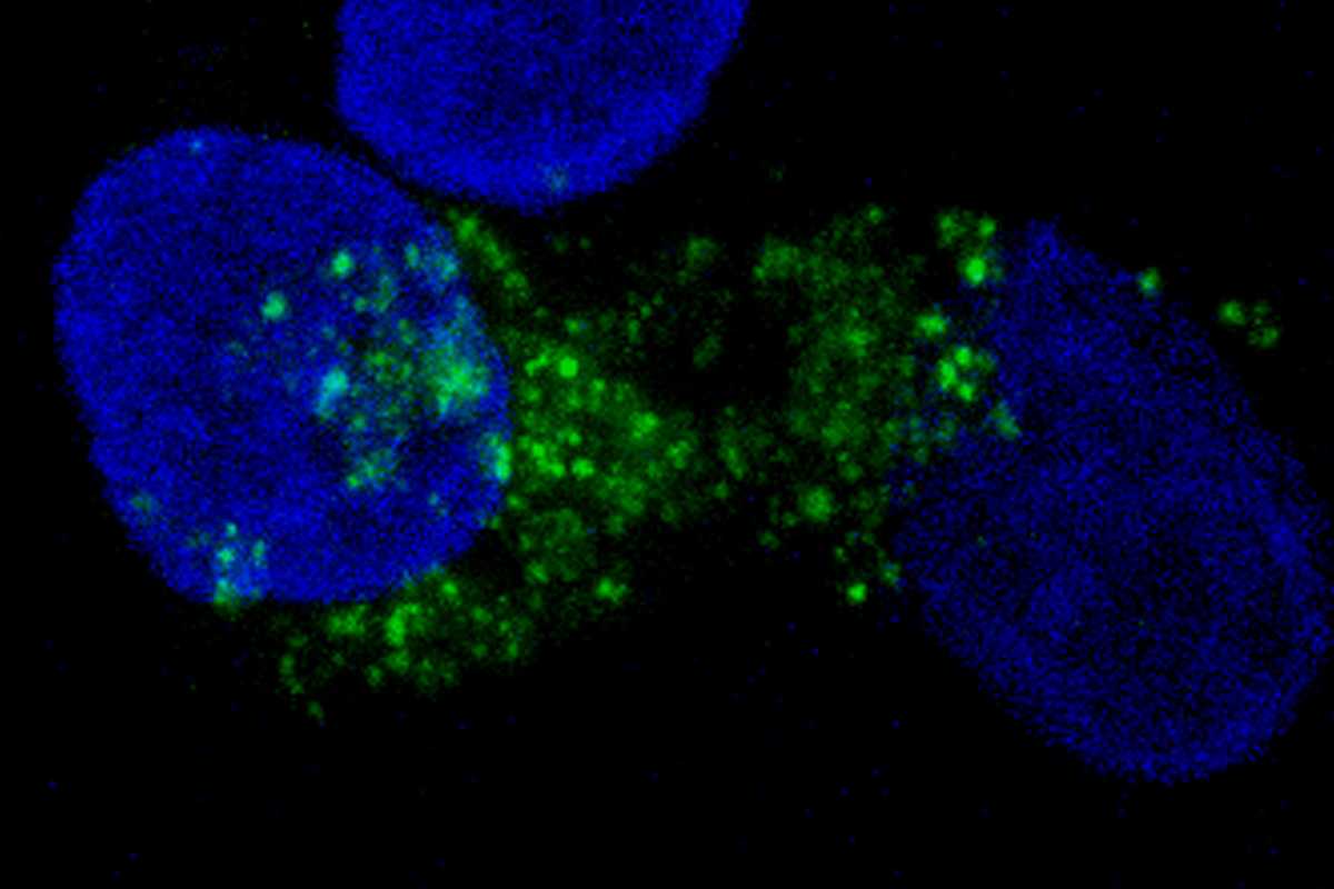 El estudio se acompaña de esta imagen: los núcleos de células tumorales en azul y en verde, los autofagosomas. Foto: UAB/ Vall d'Hebron